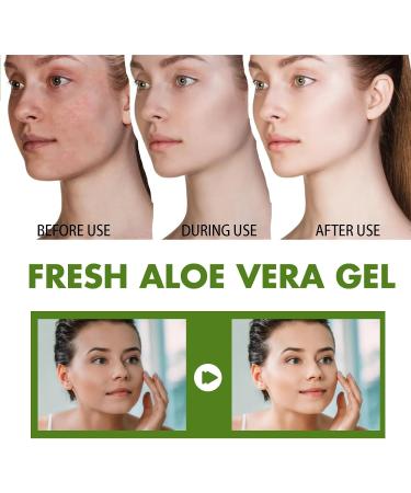 Aloe Vera Gel Pure Aloe Vera Gel For Face Aloe Vera Gel For After Sun Care And Skin Care Moisturizing Aloe Vera Cream 100% Natural Aloe Vera Gel Hydrating Aloe Vera Moisturiser - Buy Online on GoSupps.com