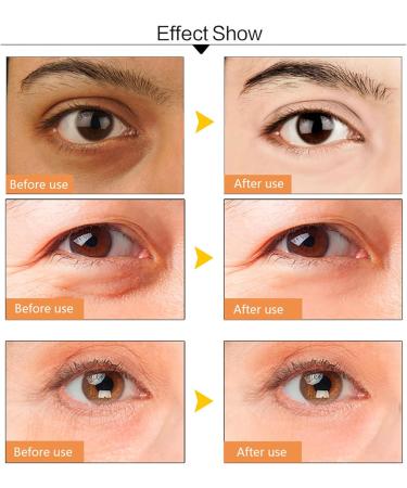 Under Eye Patches Collagen 24K Gold Eye Masks for Puffy Eyes Dark Circles Bags Gold Eye Pads Anti-Aging Hyaluronic Acid Moisturiser for Under Eye Wrinkles Remove Eye Bags Hydrating (10Pairs) - Buy Online on GoSupps.com