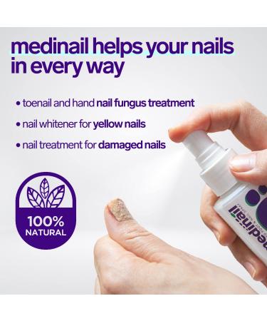 Medinail Fungus Spray - Advanced Nail Fungus Treatment and Strengthener 3.38 Fl Oz - Buy Online on GoSupps.com