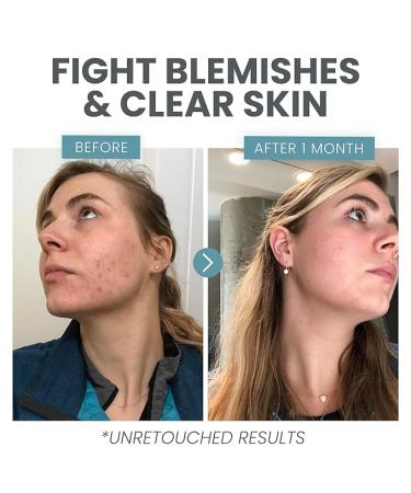 Vitamin C Plus Skin Clearing Serum - Anti-Aging & Brightening with Hyaluronic Acid & Retinol (1 oz) - Buy Online on GoSupps.com