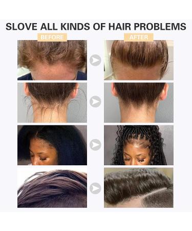 SPRINGSUGAR Hair Wax Stick + Finishing Gel + Eyebrow Soap | Non-Greasy Styling for Frizz & Flyaways - Buy Online on GoSupps.com