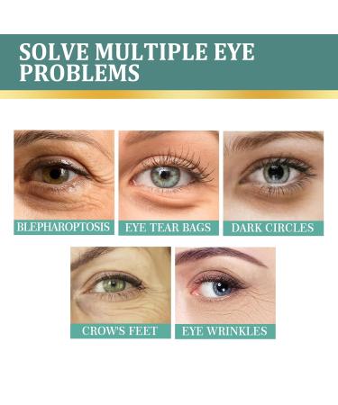 Jasmine Ointment for Dark Circles & Wrinkles | Eye Cream with Collagen & Aloe Vera | 100ml - Buy Online on GoSupps.com