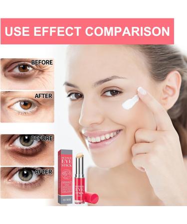 Retinol Eye Stick for Dark Circles Reduces Fine Lines and Dark Circles Under Eye Cream Eye Balm Stick for Women Retinol Eye Stick Eye Cream for Puffiness - Buy Online on GoSupps.com