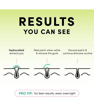 Dots for Spots Pimple Patches - Dots for Spots Pimple Patches - 60 patches - 60 patches - Buy Online on GoSupps.com