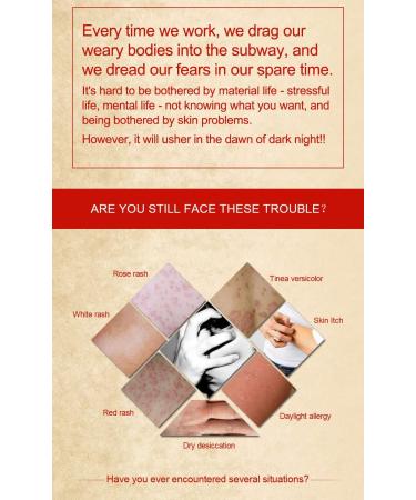 JIAHAO 10 Piece YDF Cream Redness Itchiness Eczema Rosacea Cutitis Skin Health Saver Chinese Herbal Cream - Buy Online on GoSupps.com