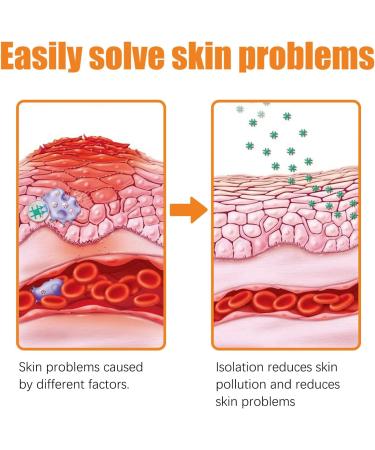 Yanolam Youth Bee Venom Psoriasis Treatment Cream - Soothing & Moisturizing Professional Care from New Zealand (1) - Buy Online on GoSupps.com