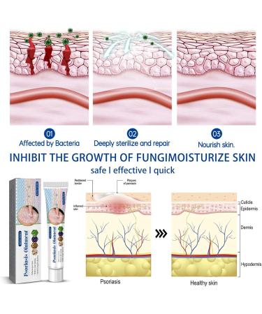 FRTG Dermatitis and eczema cream itching and irritated skin suitable for dry skin eczema and psoriasis caring cream for dry and sensitive skin 1 - Buy Online on GoSupps.com