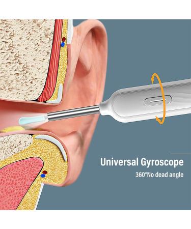 Buy Earwax Remover Otoscope - WIFI Ear Cleaner with HD Camera & 360 Wide Angle for iPhone iPad & Smartphones - International Shipping Available - Buy Online on GoSupps.com