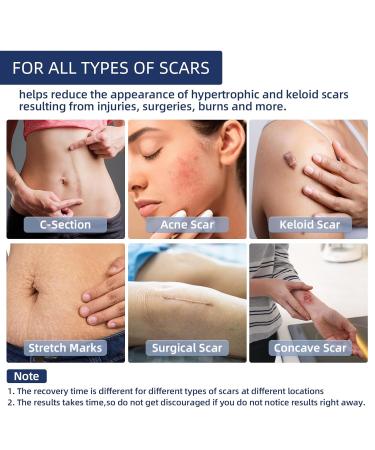 Silicone Scar Gel Cream for Face & Body | Advanced Treatment for Old & New Scars Stretch Marks Burns & Surgery - 30g (1.06 Oz - Buy Online on GoSupps.com
