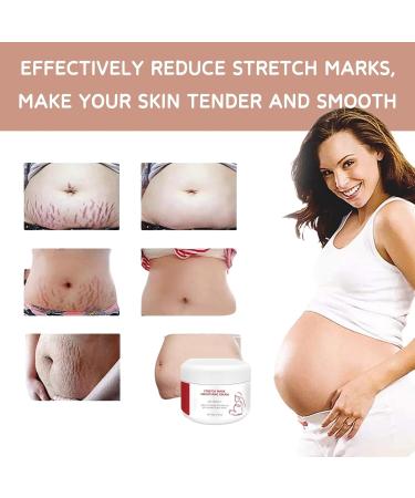 IZBEAUVO Scar Removal Cream Stretch Mark Cream Pregnancy Scar Repair Cream Anti Stretch Mark Lotion Stretch Mark Smoothing Cream Repair Scar Cream Scar Remov E for Old Stretch Marks Vitamin E - Buy Online on GoSupps.com