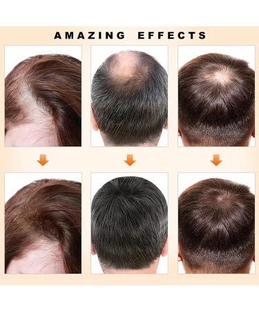 ZRIPOV Hair Growth Essential Oil - Natural Hair Regrowth Solution for Men & Women - 1.18 Fl Oz - Buy Online on GoSupps.com