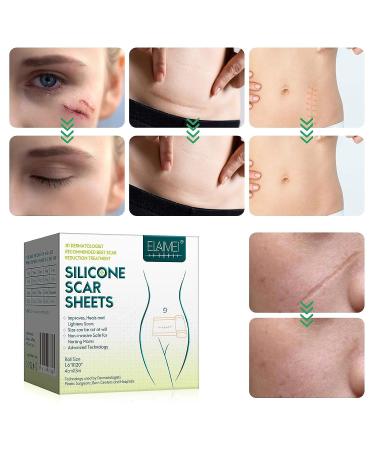 Silicone Scar Patch Roll - Professional Scar Removal Tape for Surgery, Burns, Keloid - 1.6 x 120 Roll - Buy Online on GoSupps.com