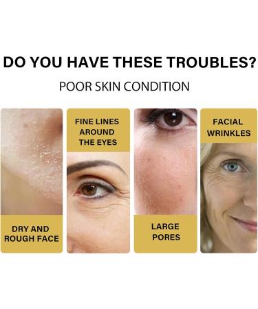 InstaLift Protein Thread Lifting Set Collagen Silk Threads for Silk Thread Lifting Thread Lifting for Skin Tightening Lifting Face for Lifting the Jawline 15 ml + 20 Pieces - Buy Online on GoSupps.com