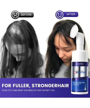 150ml Essence de Soin de Cheveux Mousse G n rique per r duire la fragilit Des Pour des plus pais et plus volumineux Pour Anti Chute Cheveux Femme et Homme Favorise la Pousse des Cheveux Plus pais - Buy Online on GoSupps.com