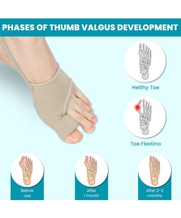 Bunion Corrector for Women & Men | Comfortable Toe Straightener Socks | Hallux Valgus Pain Relief | Breathable & Non-Slip Design - Buy Online on GoSupps.com