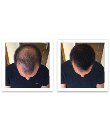 Caboki Plant-Based Hair Concealer - Covers Bald Spot & Thinning Hair - Black (16G) - Buy Online on GoSupps.com