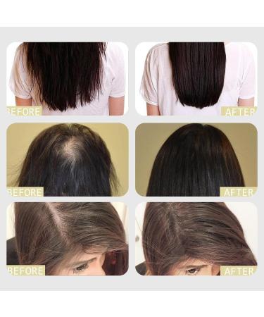 Veganic Natural Hair Growth Oil Veganic Hair Growth Oil For Hair Growth Natural Hair Growth Oil For Dry And Damaged Hair Promotes Growth And Thickness (2pc) - Buy Online on GoSupps.com