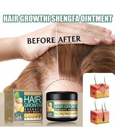 Cr me de Croissance des Cheveux Cr me Anti-chute de Cheveux Hair Regrowth Cr me Traitement de Perte de Cheveux Aide Pr venir la Chute des Cheveux pour Hommes et Femmes - Buy Online on GoSupps.com