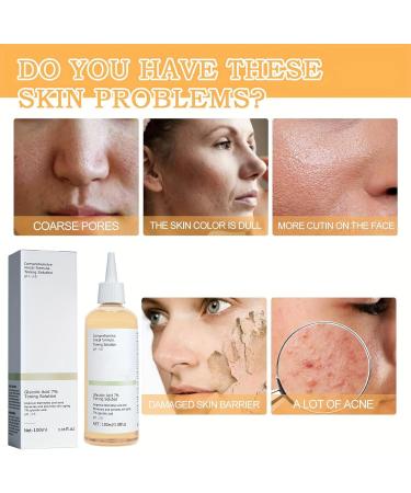100ml Glycolic Acid 7% Toning Solution Glycolic Acid Toner Glycolic Acid Toning Resurfacing Solution Glycolic Acid Serum Hyaluronic Acid Serum for Face Glycolic Acid Cream Moisturize & Strengthen Skin - Buy Online on GoSupps.com