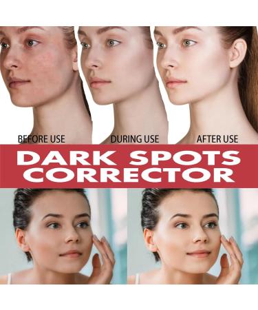 Dark Spot Correcting Serum Face Serum for Women Dark Correcting Serum Niacinamide Serum 10% Niacinamide+ 4% Tran-examic Acid Brightening Hydrating Face Serum Dark Spot Correcting Glow Serum Skincare - Buy Online on GoSupps.com