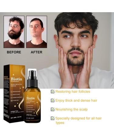 Biotin Hair Growth Serum Hair Growth Spray Anti-Hair Loss Hair Care Oil Nourishes Hair & Scalp Hair Growth Oil for Women & Men Prevent Hair Loss & Thinning 20ml - Buy Online on GoSupps.com