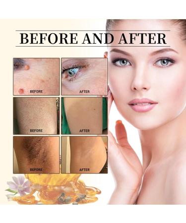 Buy Bee Venom Cream | Repair & Treat Moles & Warts | Professional Skin Correcting Gel for All Skin Types - International Shipping Available - Buy Online on GoSupps.com