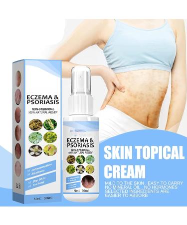 Lymard Meellop Herbal Psoriasis and Eczema Relief Spray - Soothes Itching and Burning (2 Pack) - Buy Online on GoSupps.com