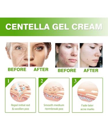 Nmbol Cream Instant Anti-wrinkle WL 1 - Buy Online on GoSupps.com