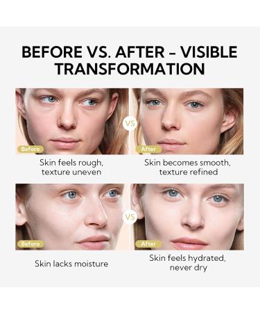 LANBENA Body and Face Peeling Spray - Exfoliating Care for Hands Knees Elbows & More with Natural Aloe Vera - 30ml International Shipping Available - Buy Online on GoSupps.com