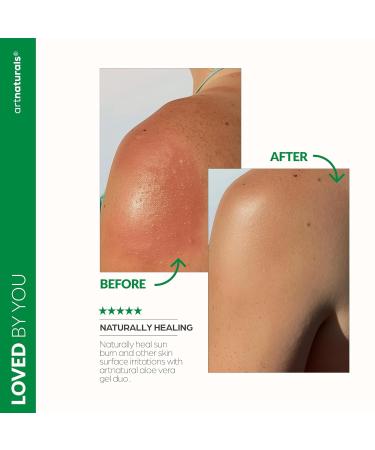 artnaturals Aloe Vera Gel Set - JUMBO 20oz - Sunburn Relief & Hydration for Face Body Scalp & Hair - Calming Moisturizer After Sun Exposure - Freshly Harvested within 12 Hours - Buy Online on GoSupps.com