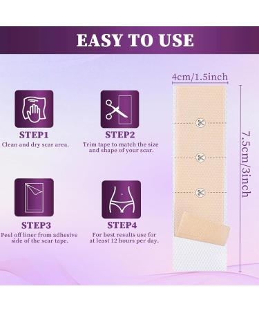 Silicone Scar Removal Tape - Fast Acting Soft Strips for Surgery & Injuries - 4 PCS - Buy Online on GoSupps.com
