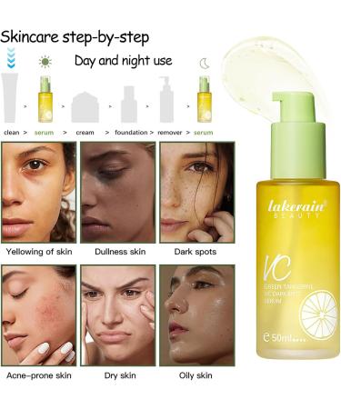 Green Tangerine Vitamin C Serum - Dark Spot Remover for Face - Face Serum for Women & Men - Brightening Moisturizing Facial Serum - Anti-wrinkle Anti-aging Antioxidant Serum 50ml - Buy Online on GoSupps.com