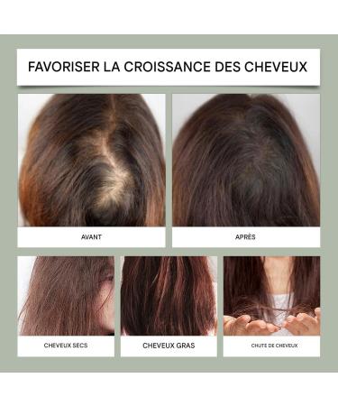 Apr s-Shampoing Capillaire - R paration des Fourches et des Pointes Ab m es | Soin Hydratant pour Cheveux Secs Fris s Ab m s Femme Anti-Frisottis Styling Thermique - Buy Online on GoSupps.com