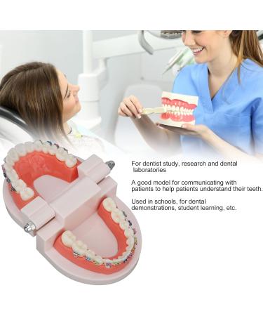 Tooth Demonstration Model - Dental Typodont with Orthodontic Bracket for Dentist Research | International Shipping - Buy Online on GoSupps.com