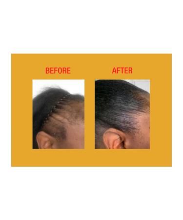 GOOD2GRO Hair Resuscitator & Edge Control - Regrow & Repair Thicker Edges | Vegan Cruelty-Free | International Shipping Available - Buy Online on GoSupps.com