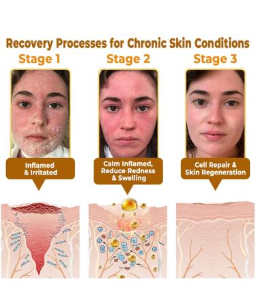 PUROSA Bee Venom Wrinkle Firming Multi-Purpose Cream Professional Bee Venom Skin Treatment Cream Bee Venom Skin Restoration Cream-50g Natural Ingredients Suitable for All Skin Types (1 Bottle) - Buy Online on GoSupps.com