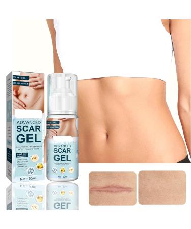 Stretch Mark Gel 2Pcs 50ml with Allantoin & Vitamin E - Hydrating Scar Remover for Scars, Burns & Surgery - Buy Online on GoSupps.com