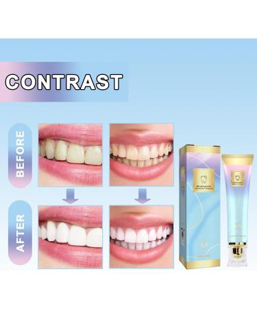 Brightening Toothpaste with Niacinamide & Mint Leaf Extract Gentle Stain Removal Teeth Whitening Fresh Breath & Gum Care(1PCS) 1 Fl Oz (Pack of 1) - Buy Online on GoSupps.com