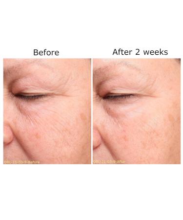 RHR Overnight Mask - Daily Face Moisturizer with Hyaluronic Acid & Heptapeptides | Brighten & Rejuvenate for All Skin Types | Pack of 14 - Buy Online on GoSupps.com