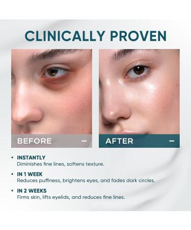 Elvira Dual Eye Cream for Dark Circles Puffiness Eye Bags Wrinkles Age-Defying Tightening and Moisturizing with Advanced Retinol Five-Peptide Complex and Stem Cell Extracts 0.68 OZ Unscented - Buy Online on GoSupps.com