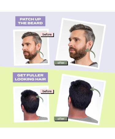  Toppik TOPPIK 12g Item Color: Medium Blonde - Buy Online on GoSupps.com