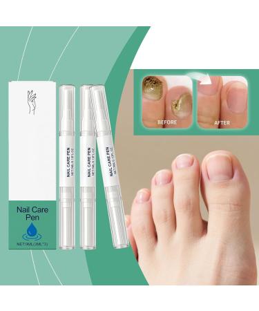 Strength Nail Pen Strengthening Nourishing Manicure Care Supplies Nail Health Pen for Damage Yellow Discolored Thick Ingrown Fingernails - Buy Online on GoSupps.com