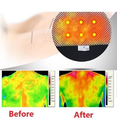 Adjustable Shoulder Brace for Men and Women - Double Shoulder Support Compression Sleeve for Rotator Cuff - Self-heating Posture Corrector & Warmer XL - Buy Online on GoSupps.com