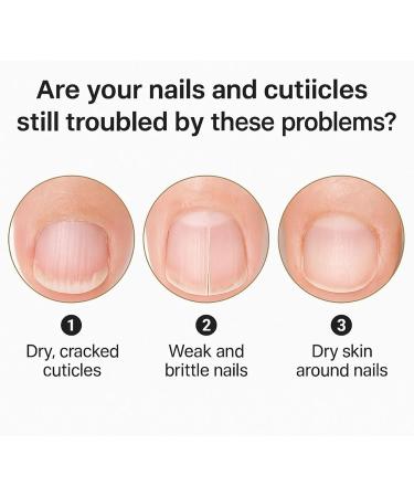  Mppchhn Stop Nail Biting | Anti-Bite Nail Polish 4ml Stop Thumb Sucking Cuticle Care for Adults and Children Boys and Girls - Buy Online on GoSupps.com
