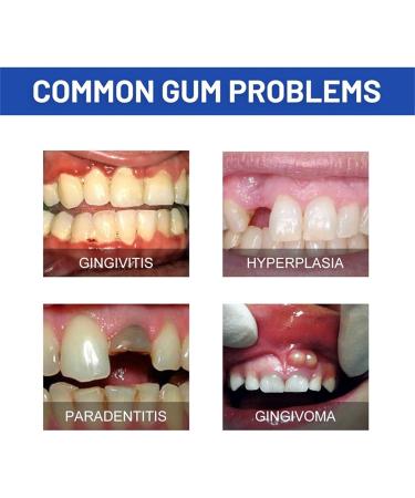 Buy Furzero Oral Gel for Gum Treatment - 3PC Gum Protection Therapy | Effective Furzero Gum Treatment Gel - Buy Online on GoSupps.com