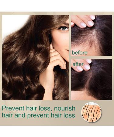 Hocossy Hair Growth Cream Hair Growth Serum Hair Loss and Thinning Hair Treatment Moisturizing Scalp Massage Rejuvenate Follicles - Buy Online on GoSupps.com