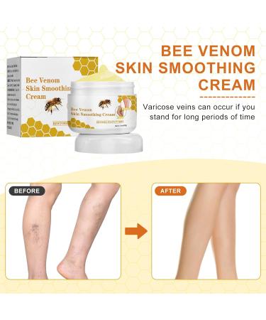Bienergiftsalbe - Varicose Veins & Spider Veins Relief Cream | Bee Venom Leg Pain & Swelling Treatment (2 Pieces) - Fast International Shipping - Buy Online on GoSupps.com
