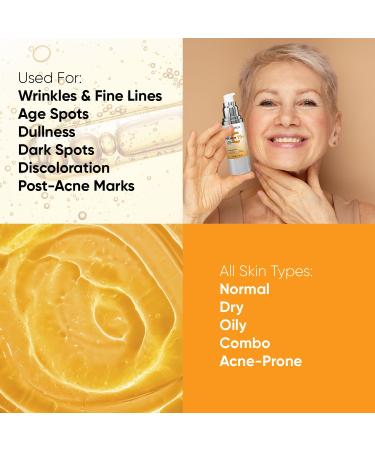 Super Vitamin C Serum for Women 60+: Hyaluronic Acid Anti-Aging Face Serum for Dark Spots & Wrinkles - Perfect for Mature Skin - Buy Online on GoSupps.com