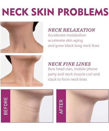 Spain Neckpon Hydrolyzed Collagen Neck Firming Cream - 2 Pack Anti-Aging & Hydrating Treatment for Youthful Skin - Buy Online on GoSupps.com