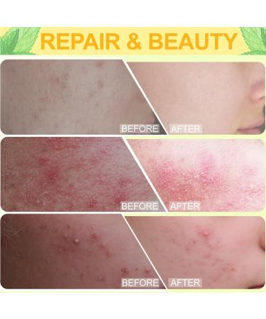 Snail Mucin Serum - 96% Power Repairing Essence | 2Pcs Hydrating Serum for Dull & Damaged Skin - Advanced Snail Secretion Filtrate - Buy Online on GoSupps.com